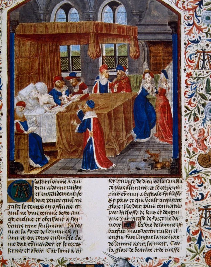 Hình ảnh minh họa một ca sinh mổ (C-section) từ thời trung cổ có tên Faits des Romains (hành động của người Roman), ghi chép về sự ra đời của Caesar.