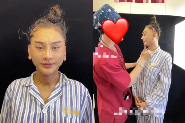 Hình ảnh Lâm Khánh Chi sang Trung Quốc để căng da mặt xuất hiện nhiều nơi, khiến người hâm mộ không khỏi xót xa. Đa số khán giả đều khuyên cô không nên tiếp tục phẫu thuật thẩm mỹ vì rất nguy hiểm.