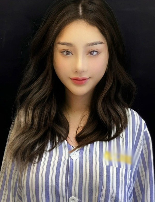 Chi cả tỷ đồng để đầu tư cho nhan sắc, sau ca đại phẫu ở tuổi 45 và 1 tuần hậu phẫu tại Trung Quốc, Lâm Khánh Chi tự tin hơn với gương mặt của mình.