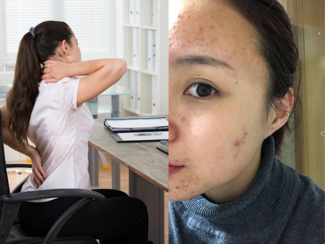 Da mặt và sức khỏe yếu đi do nàng phải ngồi văn phòng thường xuyên 