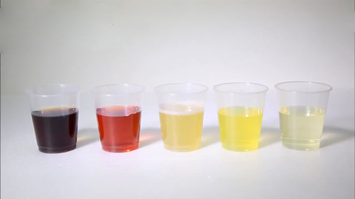 Sáng thức dậy thấy nước tiểu màu này đừng vội mừng, hãy đi viện gấp, BS chỉ cách nhìn nước tiểu biết thận khỏe, yếu