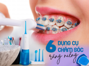Lifestyle - 6 món cần có trong túi đồ của chị em “đồng niềng”
