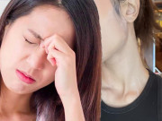 Làm đẹp - Thoa kem chống nắng bị cay mắt, có phải vì dùng "hàng dởm"?