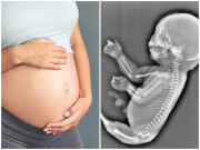 Bà bầu - Mẹ bầu 25 tuần đi siêu âm phát hiện thai nhi mắc dị tật kỳ lạ, sinh ra không thể sống sót