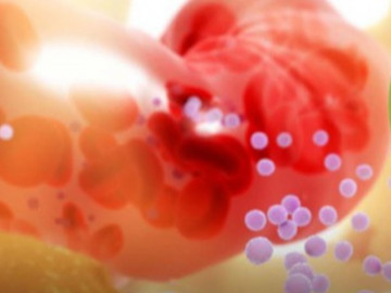 Gia tăng bệnh nhân mắc cốt tủy viêm xương hậu COVID-19, nhiều trường hợp tử vong