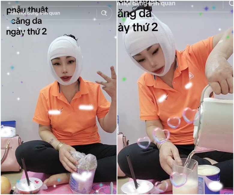 Quá trình hồi phục, cô dâu Thu Sao tỏ ra rất dày dặn kinh nghiệm trong chuyện bồi bổ thực phẩm. Mỹ nhân Cao Bằng chọn sữa đắt tiền để uống, kích thích quá trình lành thương nhanh chóng. Trong quá trình mặt đang băng bó, cô dâu Thu Sao phải nhờ cậy đến sự chăm sóc hậu phẫu của đội ngũ y tá là gội đầu.