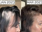 Đẹp - Ba nguyên tắc giúp TikToker "cứu" mái tóc rụng 70%