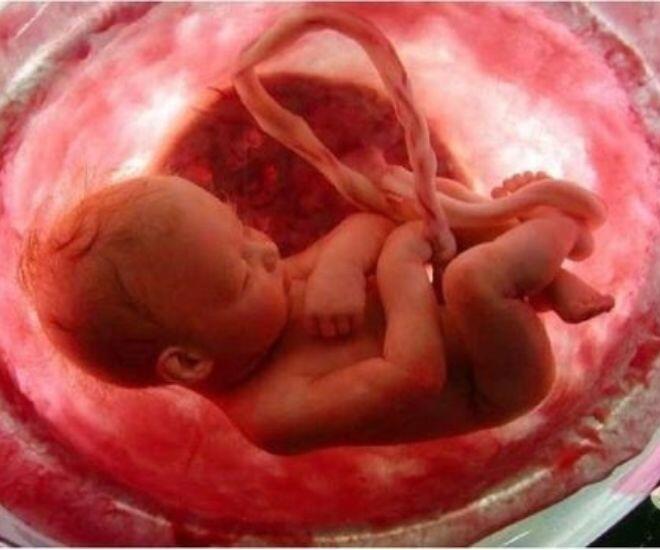 Nước ối bao quanh thai nhi có nhiều chức năng quan trọng và cần thiết cho sự phát triển khỏe mạnh của thai nhi.