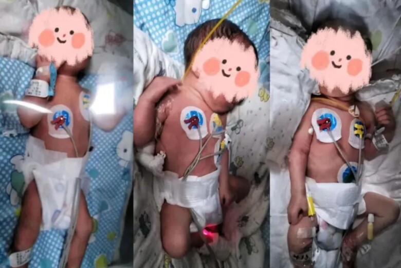 3 em bé khi mới chào đời.