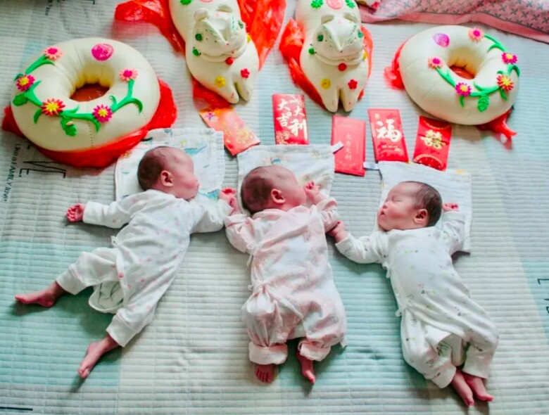 Ca sinh 3 cực hiếm có amp;#34;đủ nếp đủ tẻamp;#34;, trong 140 triệu trường hợp mới xuất hiện một ca - 2