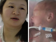 Bà bầu - Quyết giữ cả 3 con bất chấp lời khuyên của bác sĩ, bà mẹ đau đớn khi các con đều gặp vấn đề sức khỏe