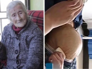 Bà bầu - Cụ bà 75 tuổi đi siêu âm thì phát hiện có thai, bác sĩ sửng sốt: “Dài 42cm và nặng 3,2kg”