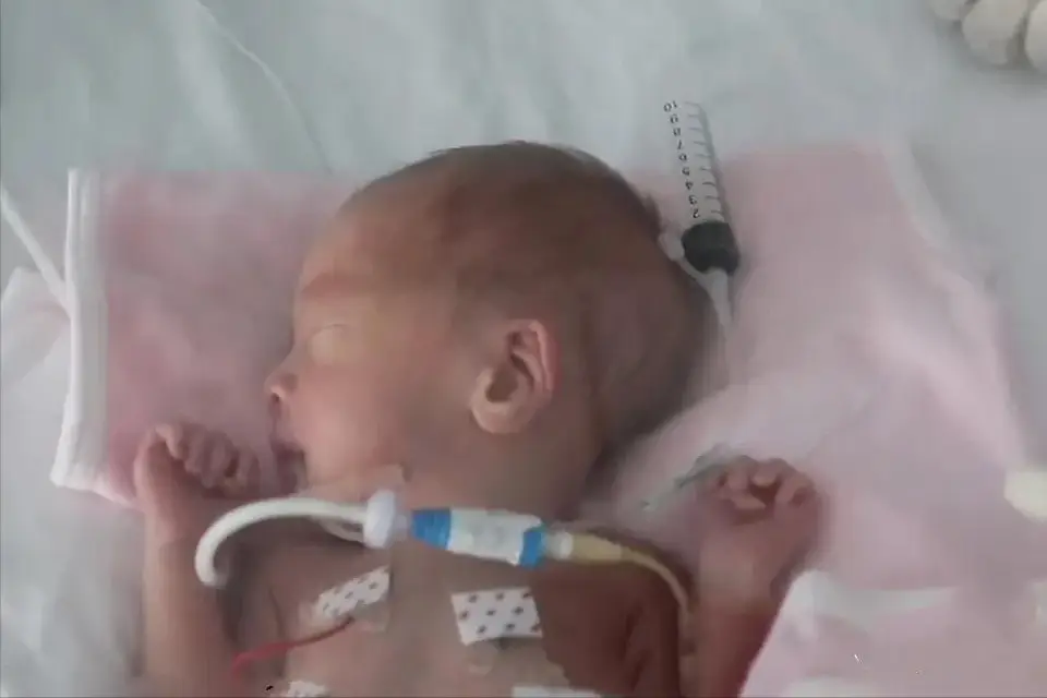 Quyết giữ cả 3 con bất chấp lời khuyên của bác sĩ, bà mẹ đau đớn khi các con đều gặp vấn đề sức khỏe - 7