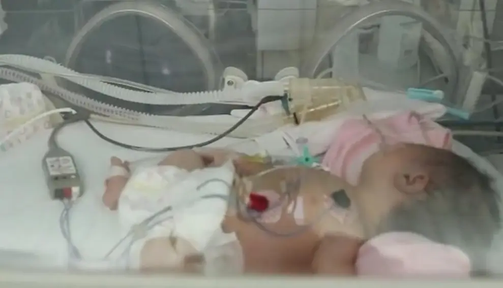 1 trong 3 đứa trẻ phải phẫu thuật não sau sinh.