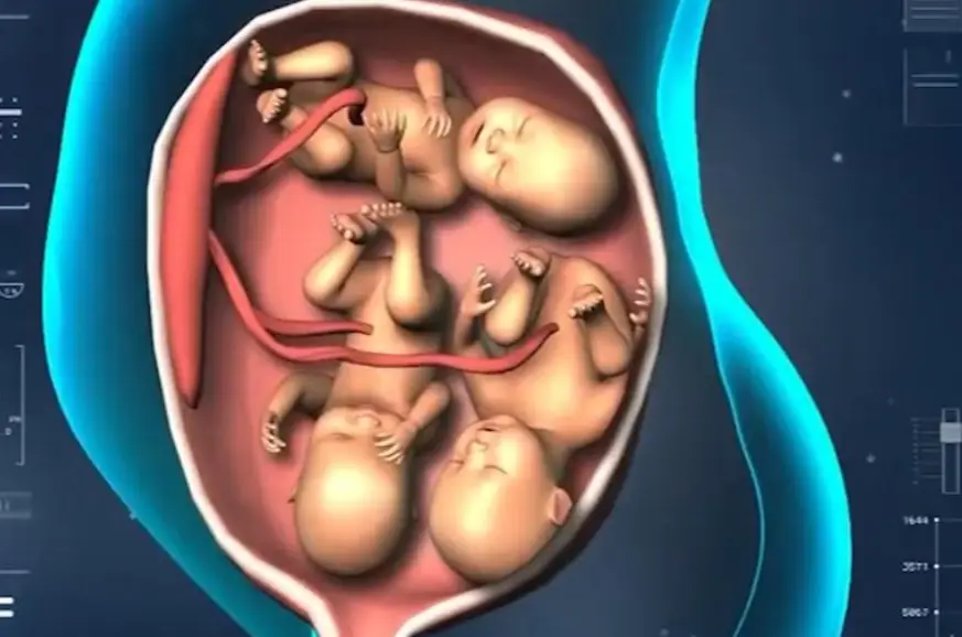 Chị Phùng kiên quyết giữ lại 3 phôi thai.