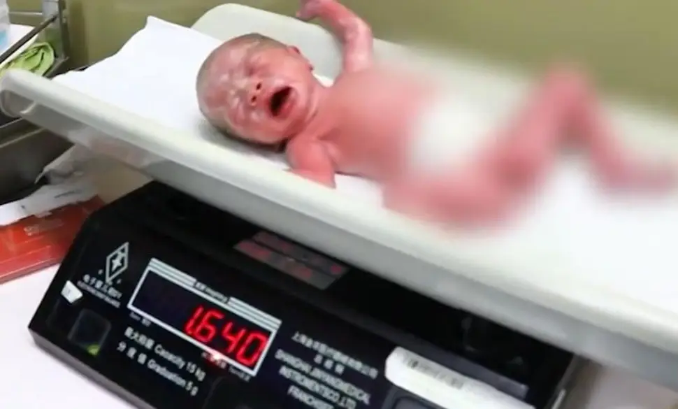 Các bé sinh non đều được có tình trạng sức khỏe không tốt.