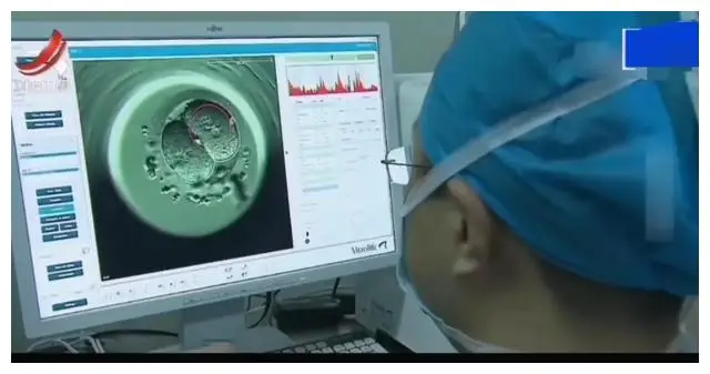 Đội ngũ y tế đã giúp bà Lý thực hiện được ước mơ làm mẹ.