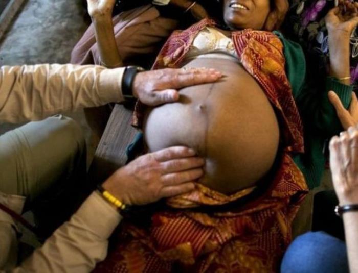 Mariam không thể kiểm soát được số lần mang thai của mình.