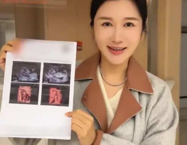 Vợ trẻ của Trương Kỷ Trung.