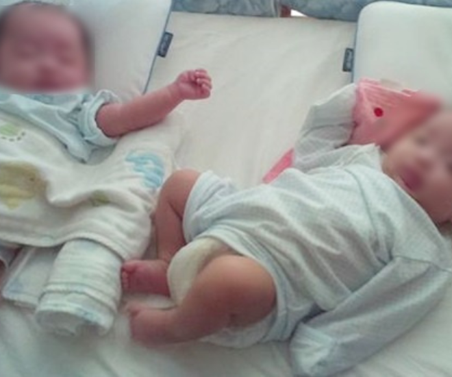 Cặp song sinh chào đời nhưng không có nét giống bố.