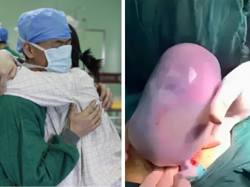 Bà mẹ 9X sinh con nhìn như thạch rau câu, chồng hoảng sợ nhưng bác sĩ lại chúc mừng