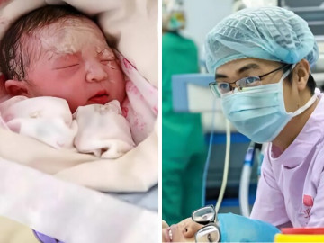 Mẹ bầu 9x hạ sinh em bé người tuyết, chồng sững sờ còn bác sĩ thì chúc mừng