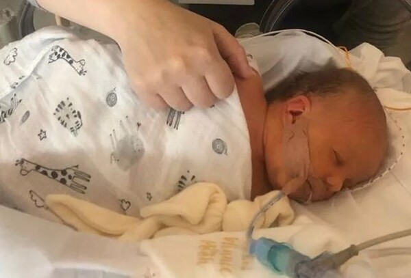 A newborn baby being cared for in a special ward