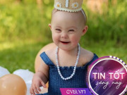 Tin tức - Từ nước mắt đến nụ cười của người mẹ có con gái mắc hội chứng Down