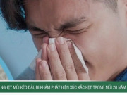 Clip Eva - Nghẹt mũi kéo dài, đi khám phát hiện xúc xắc kẹt trong mũi 20 năm