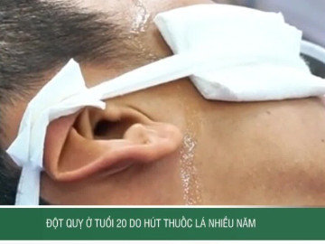 Thanh niên 20 tuổi đột quỵ do hút thuốc lá nhiều năm