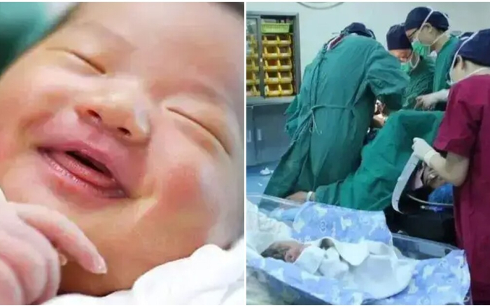 Con sơ sinh chào đời mỉm cười nhìn mẹ liền bị bác sĩ tát, bà ...