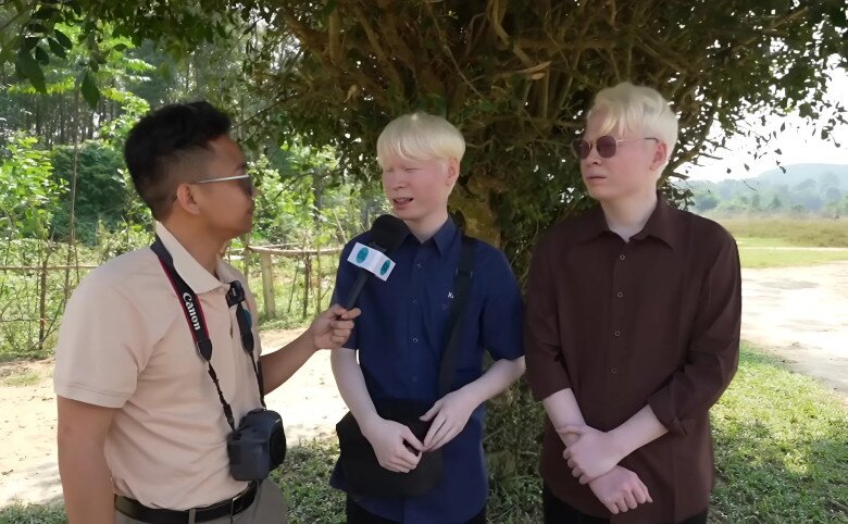 Hai anh em không thể ra ngoài nắng lâu vì ảnh hưởng đến da và mắt.