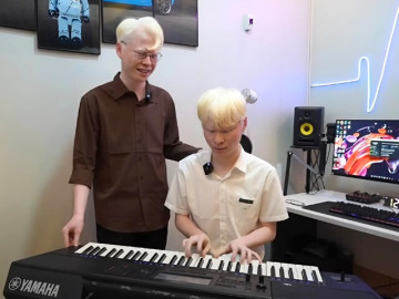 Cặp song sinh ở Hà Tĩnh mắc bệnh hiếm gặp, bị nhầm là người Tây, bỏ ngoài tai lời chê bai để lan toả nghị lực sống