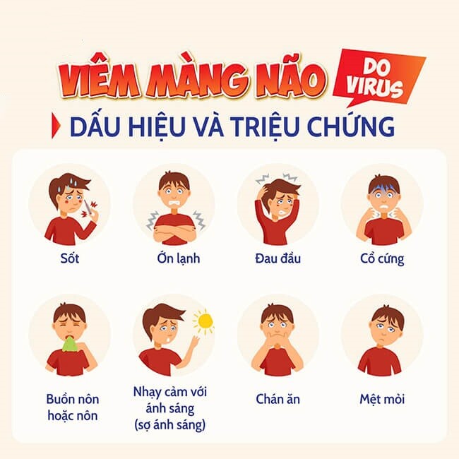 Một số dấu hiệu điển hình của viêm màng não do virus các phụ huynh cần đặc biệt chú ý. Nguồn: BV Nhi Trung ương.