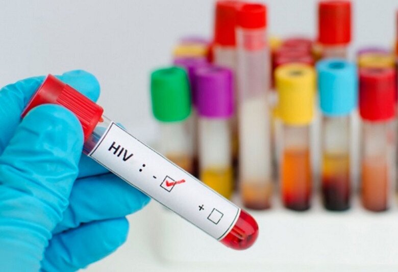 Thời điểm xét nghiệm HIV cho kết quả chính xác nhất là khoảng 2-3 tháng từ khi bị phơi nhiễm. Ảnh minh họa. 