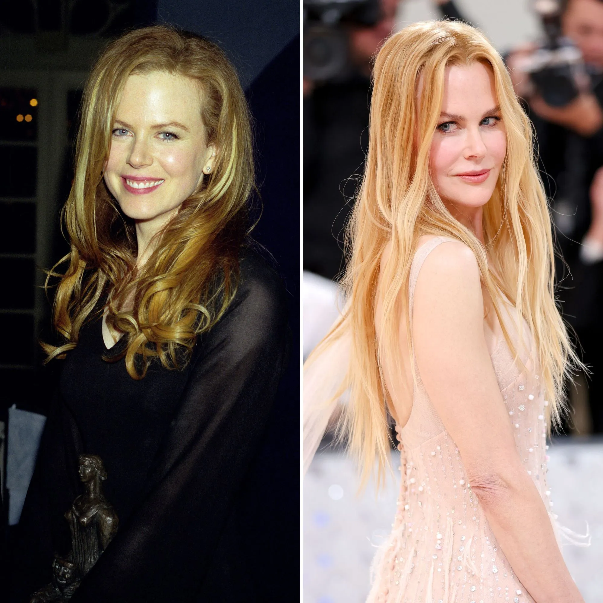 Nicole Kidman là một ví dụ điển hình, khi biểu cảm gương mặt của cô bị chỉ trích là thiếu tự nhiên do tiêm chất làm đầy quá đà. Vẻ đẹp của thiên nga nước Úc cũng dần trở nên đơ cứng. 