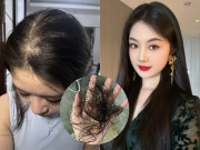 Đẹp - Tại sao tóc rụng không ngừng, ngày càng mỏng? Mách nàng 5 cách khắc phục rụng tóc hiệu quả, cho mái tóc dày đẹp
