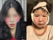 Đẹp - Những trào lưu thẩm mỹ kỳ lạ của giới trẻ, ngay cả bác sĩ "dao kéo" cũng phải hốt hoảng