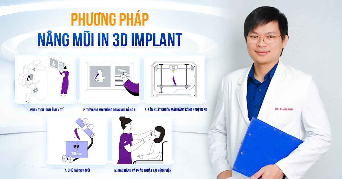 Bác sĩ Nguyễn Tuấn Anh ứng dụng thành công công nghệ nâng mũi In 3D Implant - 1