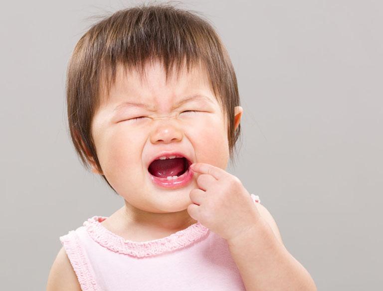 Không phải ăn kẹo, mảng bám mới chính là “thủ phạm” gây sâu răng sữa ở trẻ - 3