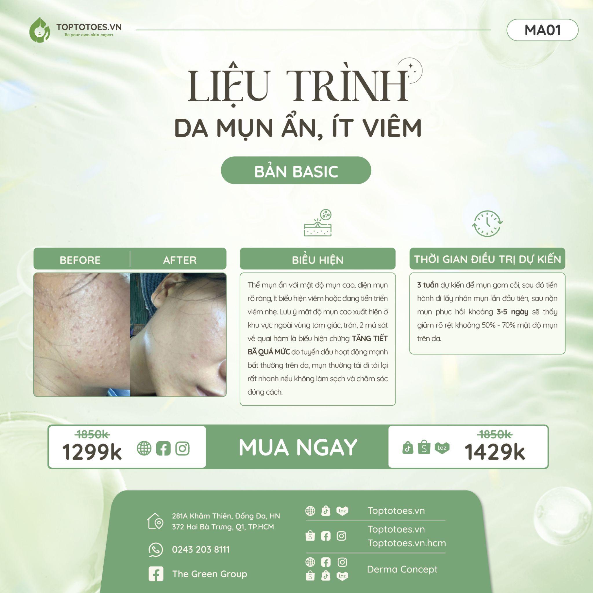 Sau khoảng 3-4 tuần điều trị theo liệu trình da mặt của khách hàng đã có sự cải thiện rõ rệt