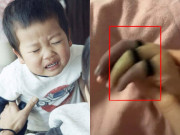 Yêu con - Con sang nhà hàng xóm chơi, về nhà bỗng khóc thét, mẹ tá hoả khi thấy hai bàn tay con tím đen