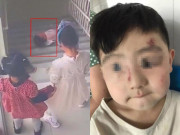 Yêu con - Đến trường đón con, bà nội tá hỏa khi chứng kiến cháu trai bị bạn học đẩy ngã cầu thang, phải nhập viện gấp