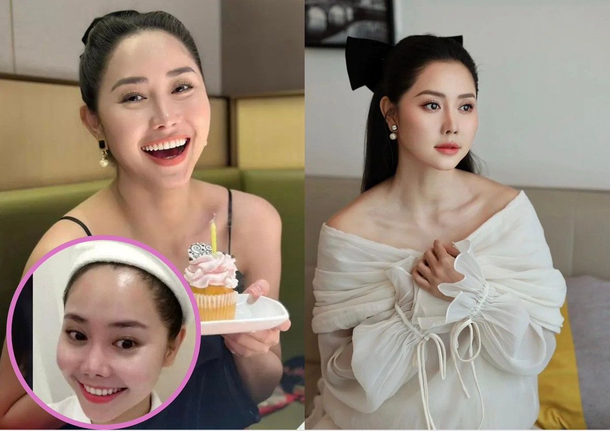 Nữ diễn viên 3 lần sửa mũi hỏng nay nhan sắc amp;#34;lên hươngamp;#34; tuổi 35 - 3