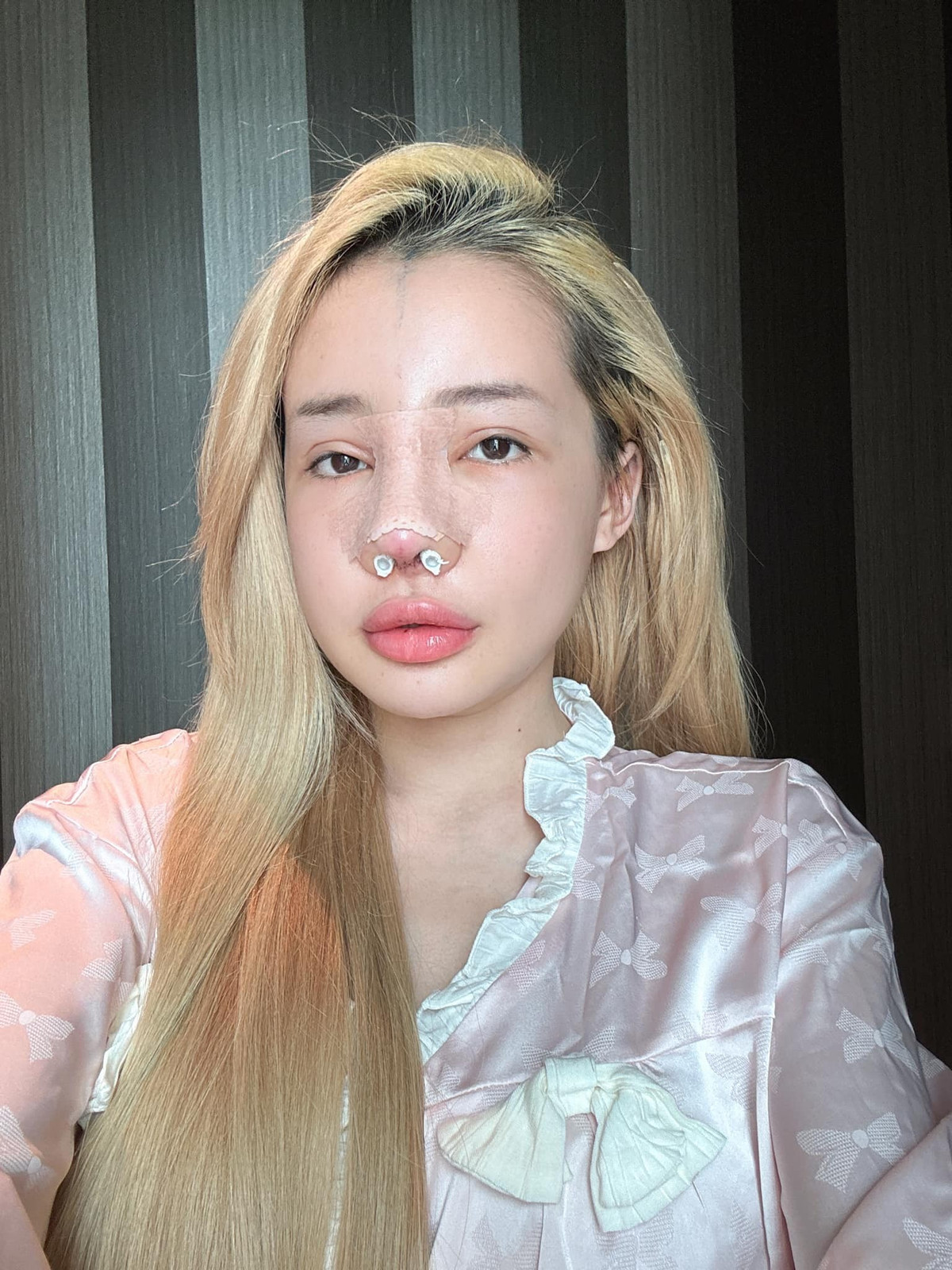 10 năm qua, Ngân 98 từng amp;#34;nghiệnamp;#34; phẫu thuật thẩm mỹ ra sao? - 7