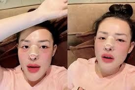 10 năm qua, Ngân 98 từng amp;#34;nghiệnamp;#34; phẫu thuật thẩm mỹ ra sao? - 9