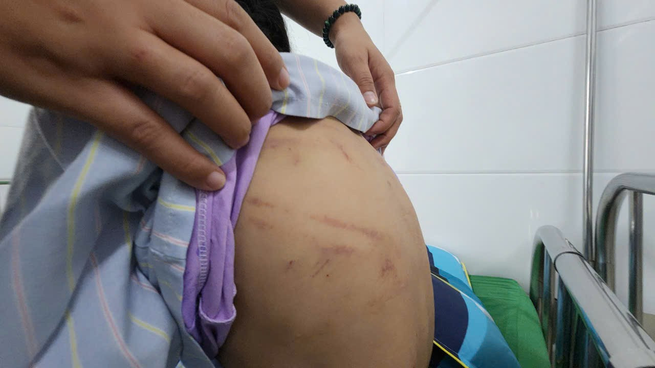 Những vết thương cũ chi chít trên người nạn nhân.