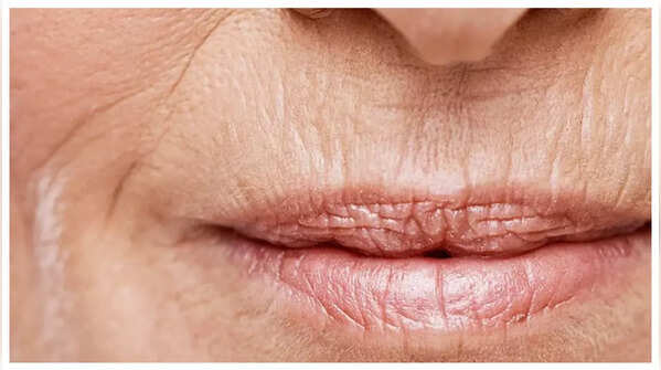 Da bắt đầu xuất hiện các nếp nhăn và đường nhăn nhỏ.