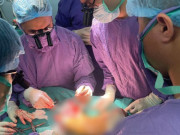 Nối chân đứt rời cho cô gái 19 tuổi sau va chạm với xe mô tô phân khối lớn