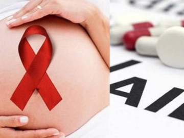 Giảm nguy cơ lây HIV từ mẹ sang con: Sinh mổ hay sinh thường, chọn sao cho đúng?